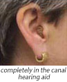 completely-in-the-canal-hearing-aid