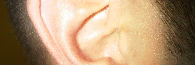 Is ear wax causing hearing loss?