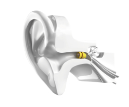 Lyric hearing aids shown in the ear